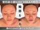 ミチカ(MICHIKA)の写真