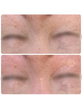 ヒスイ バイ アメイジング(Hisui by AMAZING)/VAR ヴィジブルエイジリバース