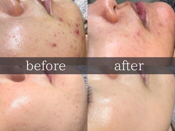 シェステ ゴジュウヨン(shesthe54)