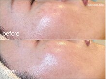 サロン ド ブラン アオヤマ(Salon de BLANC AOYAMA)/クリスティーナ美白ケア90分