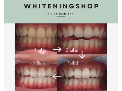 ホワイトニングショップ 元町 中華街店の写真