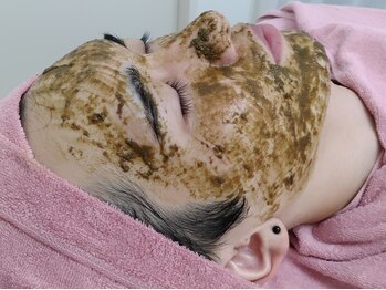 ユニクリア(Uni clear)の写真/【高品質ハーブピーリング】シミ・透明肌・リフト・ニキビケア・毛穴黒ずみ◎剥離なし翌日メイクOK