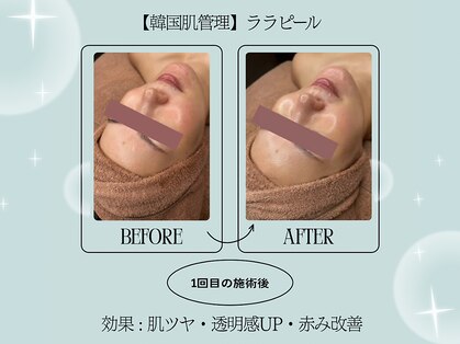 エクラルム(Eclaleum)の写真