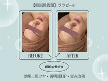 エクラルム(Eclaleum)