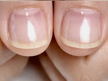 プライベートネイルサロン ケイト(Kate)