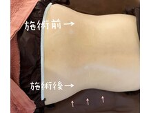 ビューティーセンス(Beauty 3eNSE)/くびれ!!