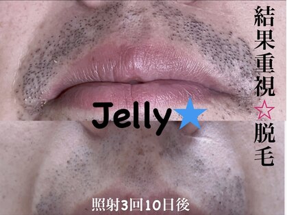 ジェリー(Jelly★)の写真