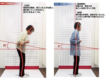 ほねつぎ 府中鍼灸整体院/【症状】　腰痛・膝痛