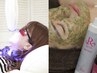 【セットでお得♪】ホワイトニング15分×２回照射×ハーブピーリング¥13,000