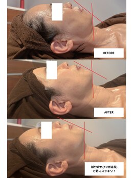 サルーテサロン(salute Salon)/ビフォーアフター