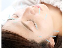 なみつき鍼灸整骨院の雰囲気（当院の特徴は、「癒される鍼灸整骨院」です◎）