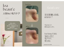 ロア ビューテ(loa beaut'e)