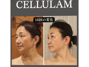 ハナヨサロン(hanayo salon)/大人気♪小顔フェイシャル