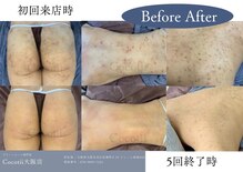 ココティー 大阪店(Cocotii)