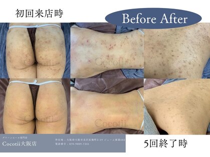 ココティー 大阪店(Cocotii)の写真