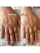 ゼロハチイチ(081)/Hand Spa Treatment