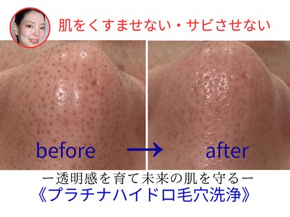 コタ(COTA)の写真