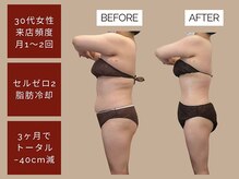 ベベティー(BEBETIE)