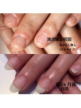 リノール(Linol)/