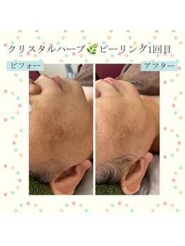 ランプ(Lampe)/◇クリスタルハーブピーリング◇