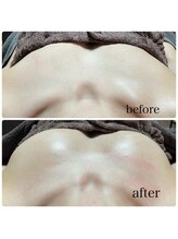 シェリアン(Cherien)/バストケア