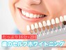 【歯セルフホワイトニング】ツルピカ★輝く白さに満足〈16分×2回〉¥5900