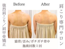 サロンルーチェ(Salon Luce)の雰囲気（肩甲骨を整え、猫背や巻き肩を改善。見た目にも美しく/肩こり）