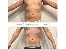 コペル 名古屋金山の雰囲気（【痩身ダイエット】体験2000円/都度◎/回数券◎夏までに★）