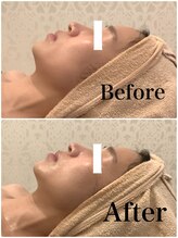 スペチアーレ 夙川/リフトアップ効果抜群