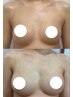 【バストプレミアム】RAVIS式育乳バストアップ術！本気で改善したい方￥9,900