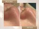 ドクターエイチ 四ツ橋堀江店(Doctor.H)の写真