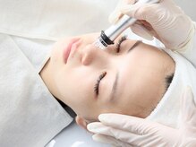 ケセラ(Quesera)の雰囲気（韓国の肌管理室で使用されている3D毛穴洗浄で黒ずみ毛穴リセット）