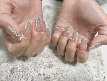 ヴィプラス(Vi+)/