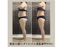 ミノ 美里大通り店(mino)/ダイエットパッケージ