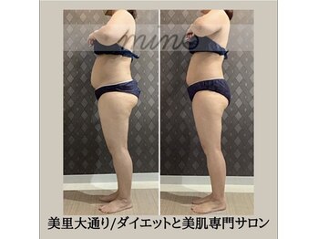 ミノ 美里大通り店(mino)/ダイエットパッケージ