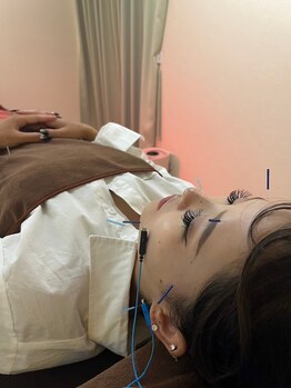 ハリファ鍼灸院 福岡博多院(HariFa鍼灸院)/施術風景