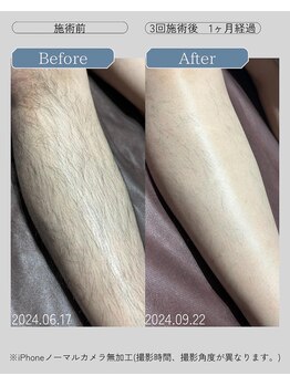 ジールクス 太田店(G LUX)/足(ひざ下)