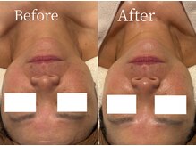 アイラブワン 大和 南林間店(eye love one)/ララピール【毛穴/小顔/リンパ】