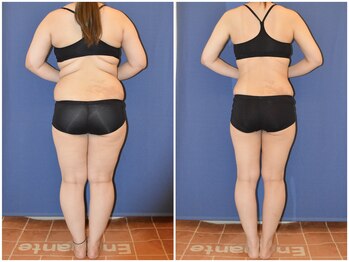 アンシャンテ姫路/痩身　姫路加古川たつの赤穂加西