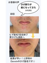 ダーウィン(Darwin)/青ヒゲが薄くなってきた！