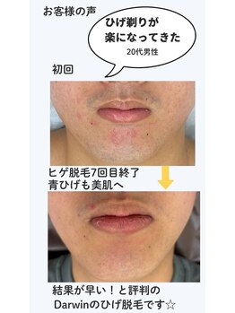 ダーウィン(Darwin)/青ヒゲが薄くなってきた!