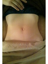 ラフ(laugh)/お腹を施術！Vラインがキレイに