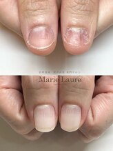 マリーロール 淀屋橋本店(Marie Laure)/自爪育成/深爪矯正/ネイルケア