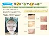 光フェイシャル（ヘッドマッサージ＆シートパック付）２０％ＯＦＦ！
