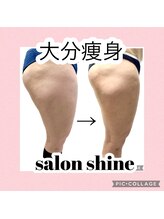 サロンシャイン(Salon Shine)/痩身マッサージ