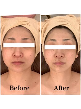 スペチアーレ 夙川/小顔と美肌で美顔革命