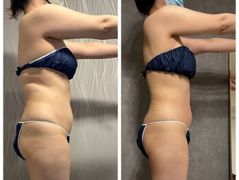 フュース(Futh)/ダイエット/サイズダウン/代謝