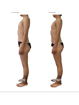 ベンザイ 新潟店(BENZAI)/肋骨の開き過ぎでバストが流れる