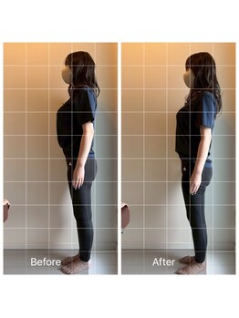 ライトワーク 西新宿店/O脚矯正・反り腰