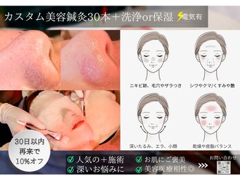 ミエリア美容鍼灸院(mielia美容鍼灸院)/◆↓カスタム美容電気鍼+美容